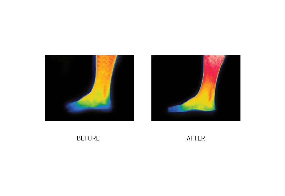 Infrared Energy Pain Relief Socks (Set of 3) - Image 4