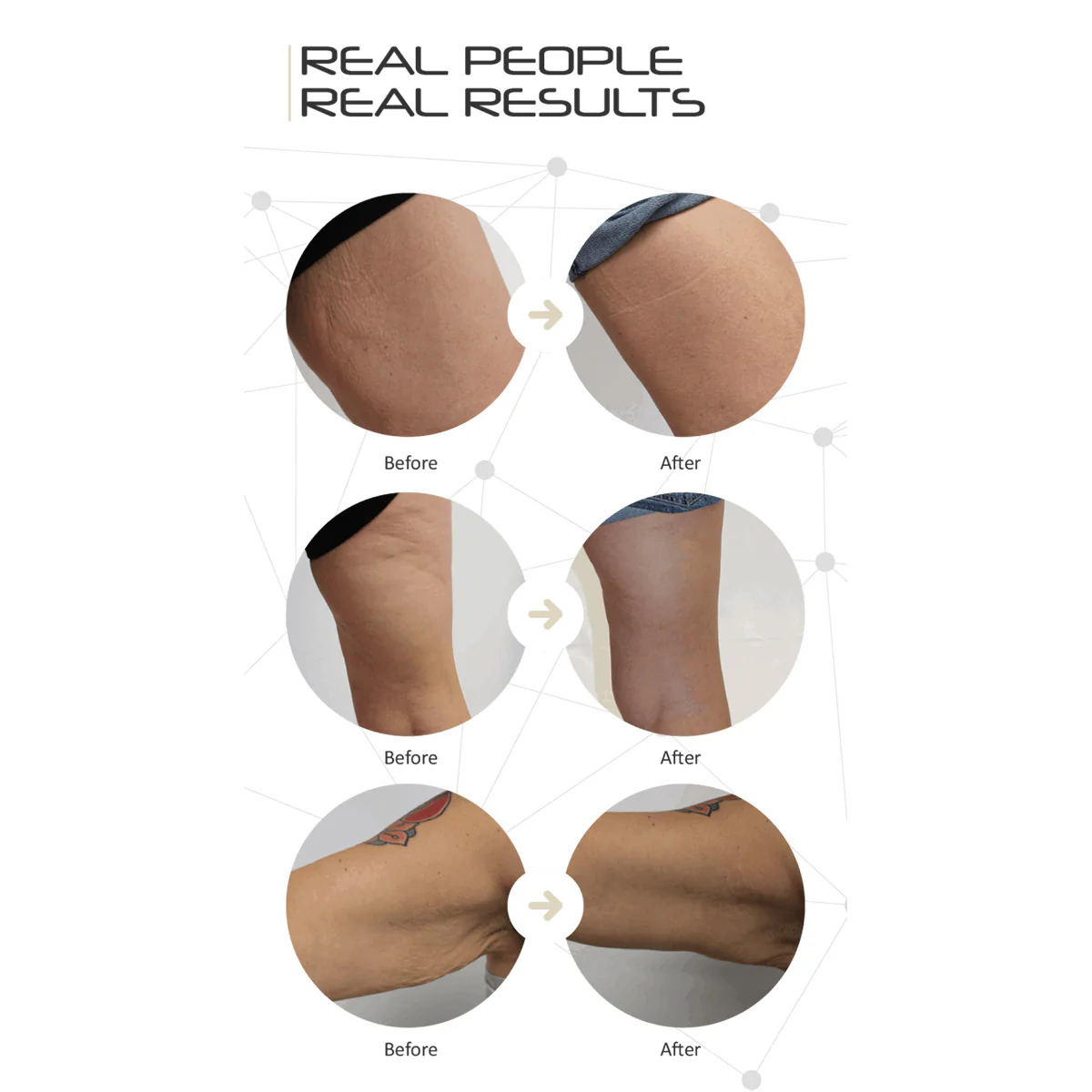 LED Cellulite Reducing Device - Image 5