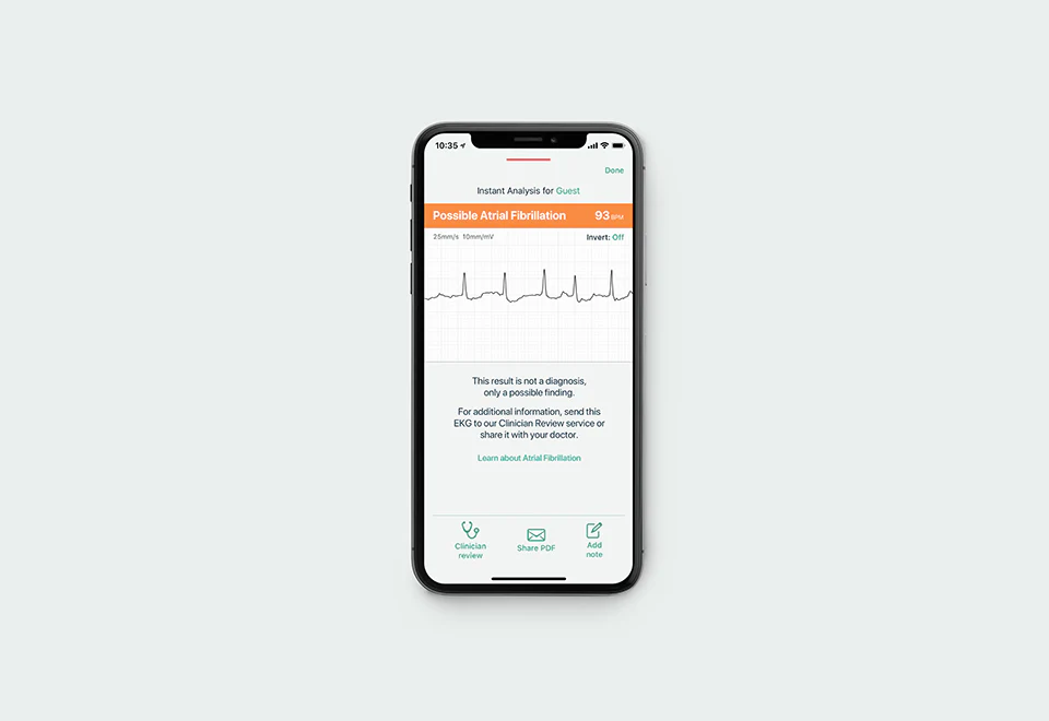 Portable EKG - Image 3