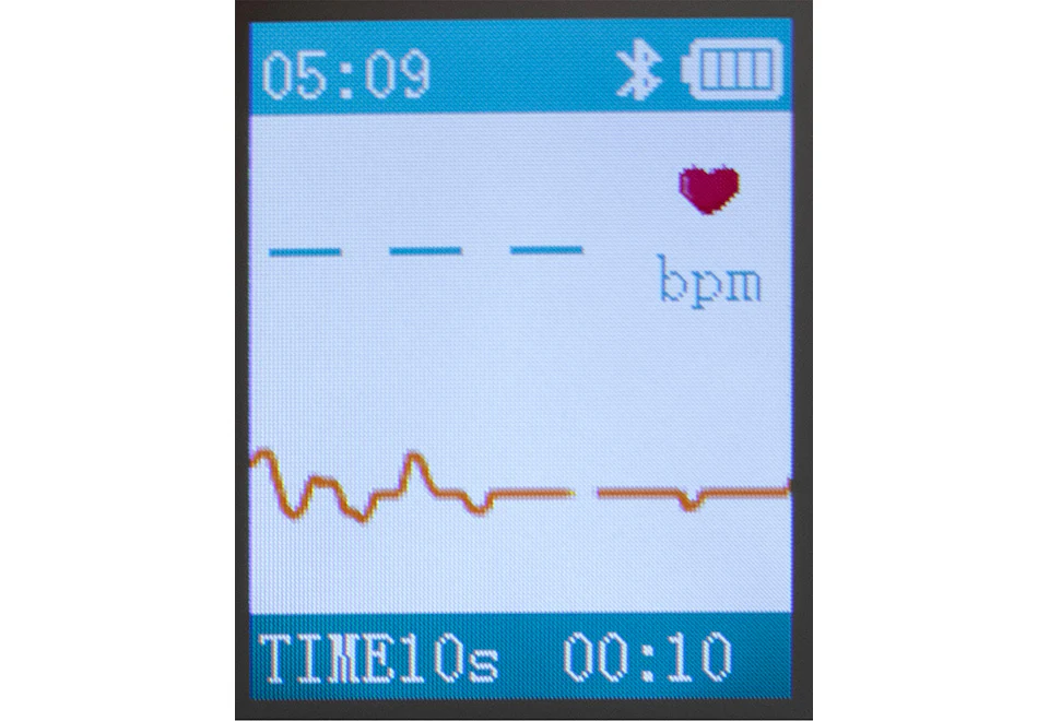 Portable Smart Bluetooth EKG Monitor - Image 4