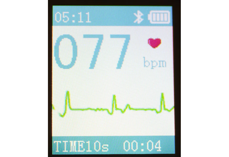 Portable Smart Bluetooth EKG Monitor - Image 5