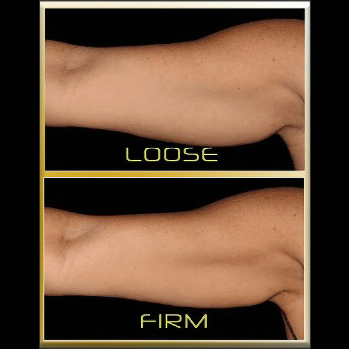 Underarm Toner - Image 5